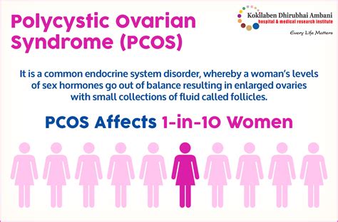 Endocrinologists For PCOS .